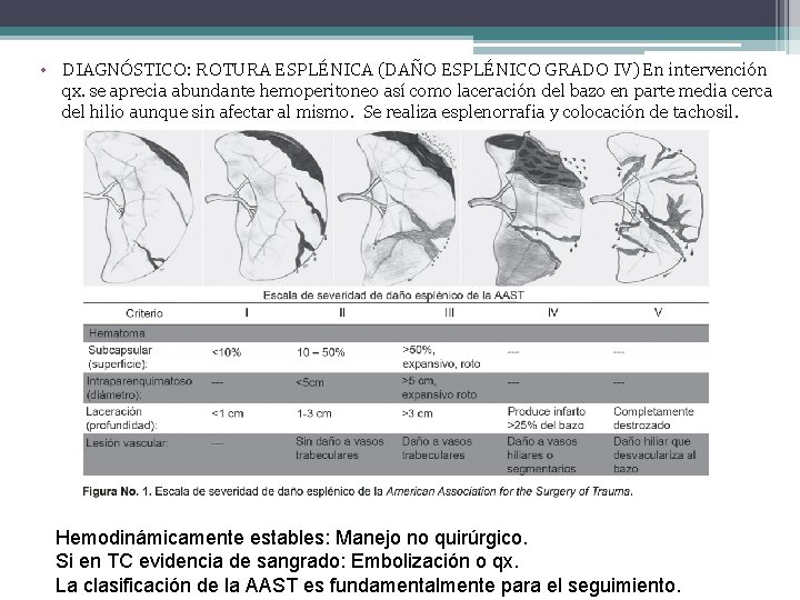  • DIAGNÓSTICO: ROTURA ESPLÉNICA (DAÑO ESPLÉNICO GRADO IV) En intervención qx. se aprecia