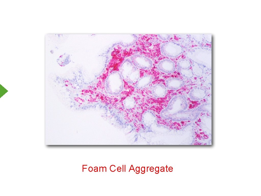 Foam Cell Aggregate 