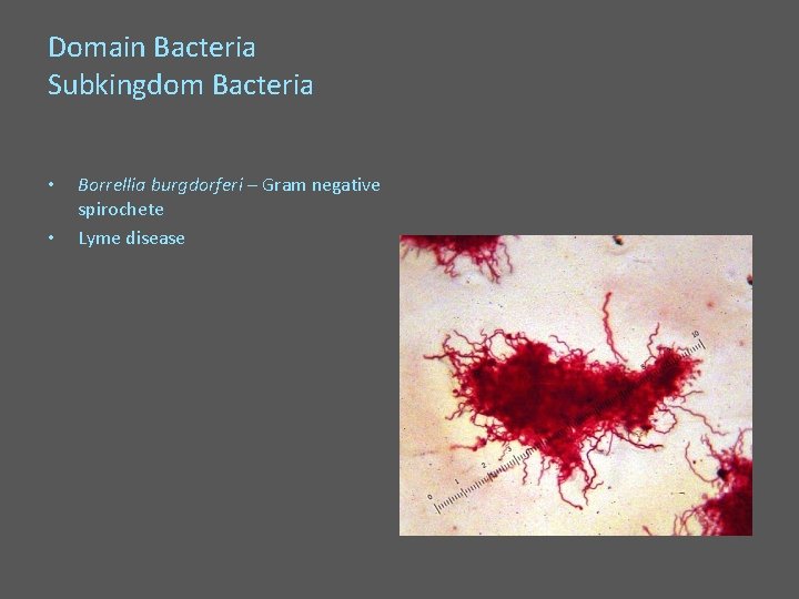 Domain Bacteria Subkingdom Bacteria • • Borrellia burgdorferi – Gram negative spirochete Lyme disease