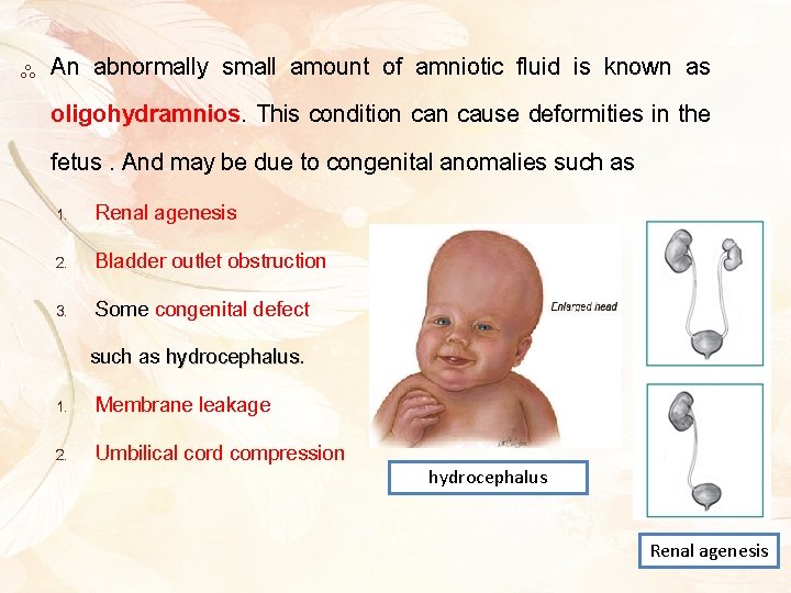 Lab 14 Amniotic Fluid Aminiotic fluid A clear