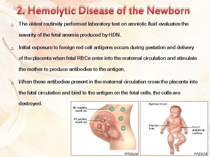 2. Hemolytic Disease of the Newborn ༜ The oldest routinely performed laboratory test on