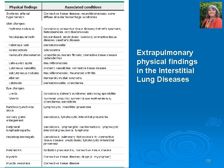 Extrapulmonary physical findings in the Interstitial Lung Diseases 19 