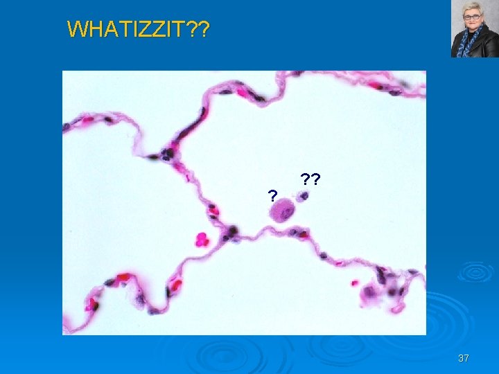 WHATIZZIT? ? ? ? ? 37 