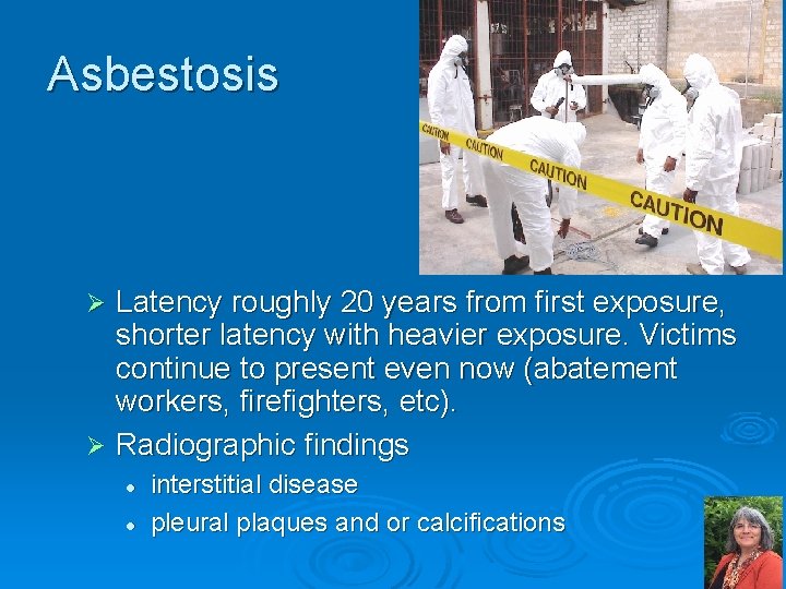 Asbestosis Latency roughly 20 years from first exposure, shorter latency with heavier exposure. Victims