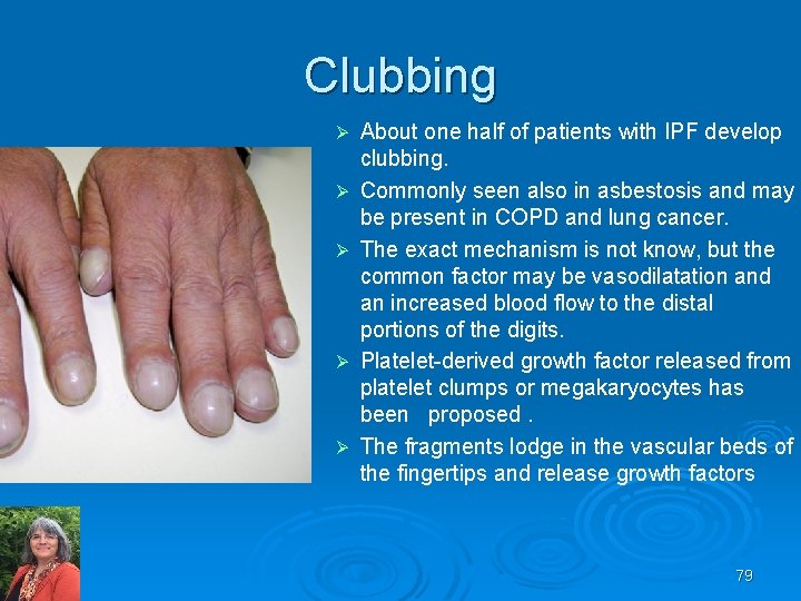 IPF Clubbing Ø Ø Ø About one half of patients with IPF develop clubbing.