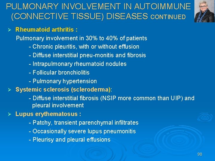 PULMONARY INVOLVEMENT IN AUTOIMMUNE (CONNECTIVE TISSUE) DISEASES CONTINUED Rheumatoid arthritis : Pulmonary involvement in