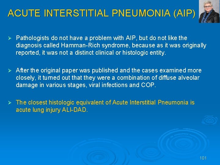 ACUTE INTERSTITIAL PNEUMONIA (AIP) Ø Pathologists do not have a problem with AIP, but