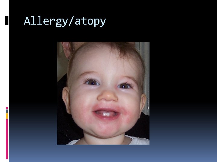 Allergy/atopy 