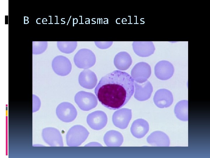 B cells/plasma cells 