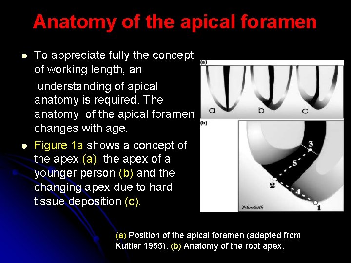 Anatomy of the apical foramen l l To appreciate fully the concept of working
