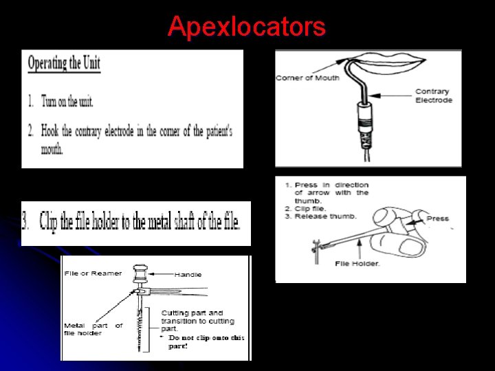 Apexlocators 