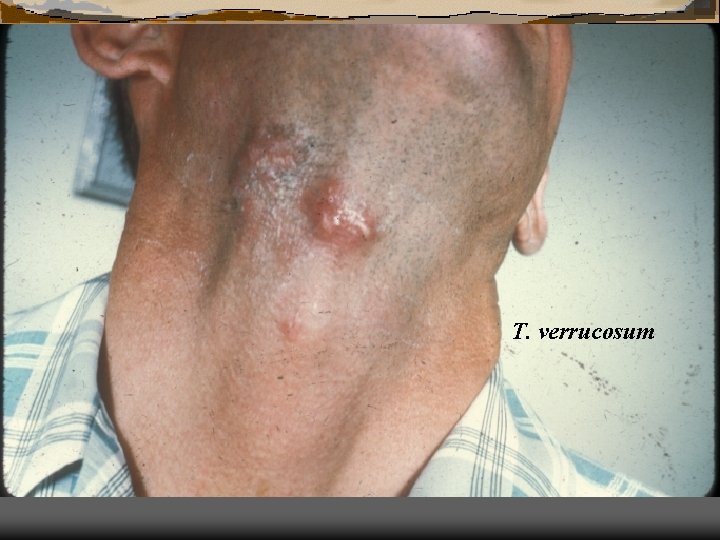 T. verrucosum 