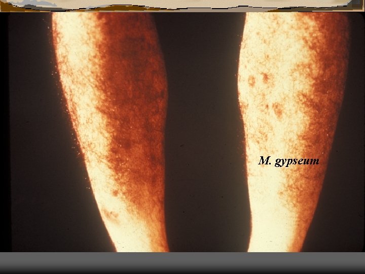 M. gypseum 