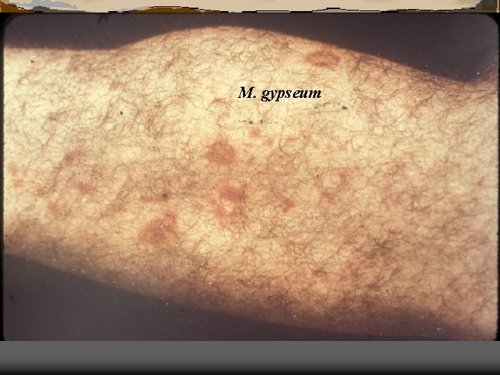 M. gypseum 
