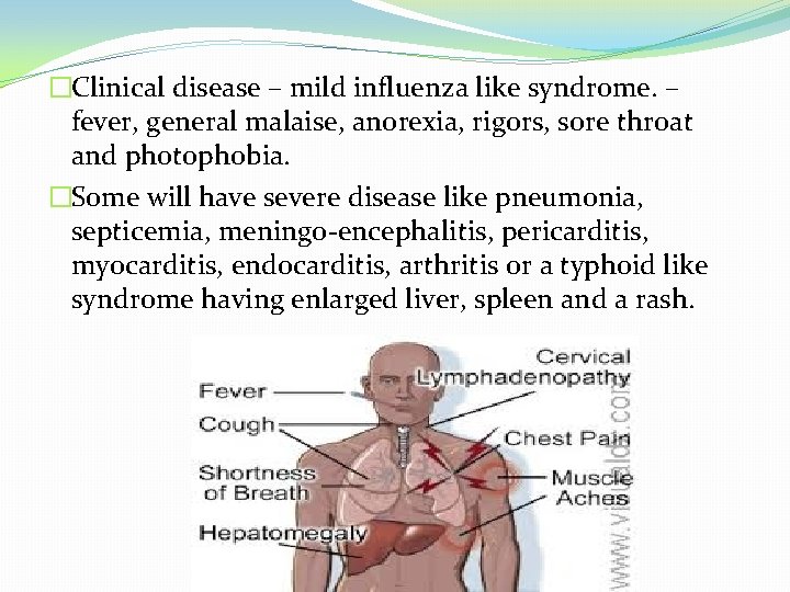 �Clinical disease – mild influenza like syndrome. – fever, general malaise, anorexia, rigors, sore