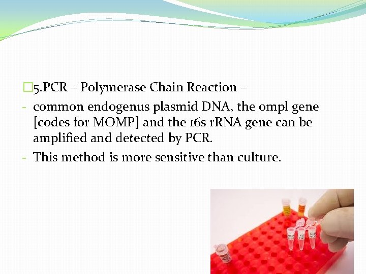 � 5. PCR – Polymerase Chain Reaction – - common endogenus plasmid DNA, the