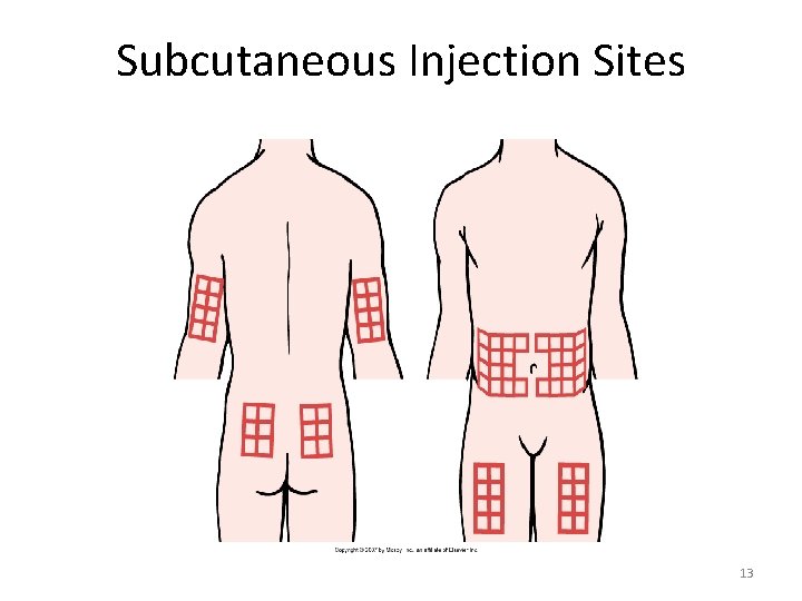 Subcutaneous Injection Sites 13 