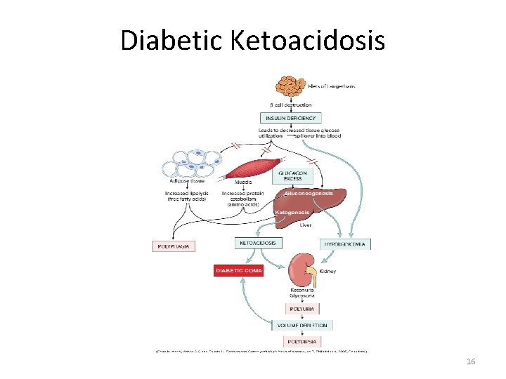 Diabetic Ketoacidosis 16 