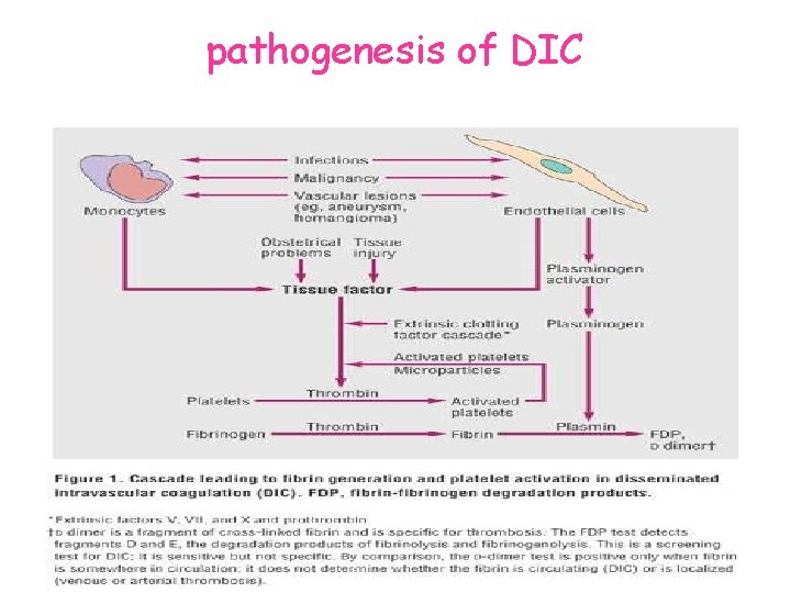 pathogenesis of DIC 