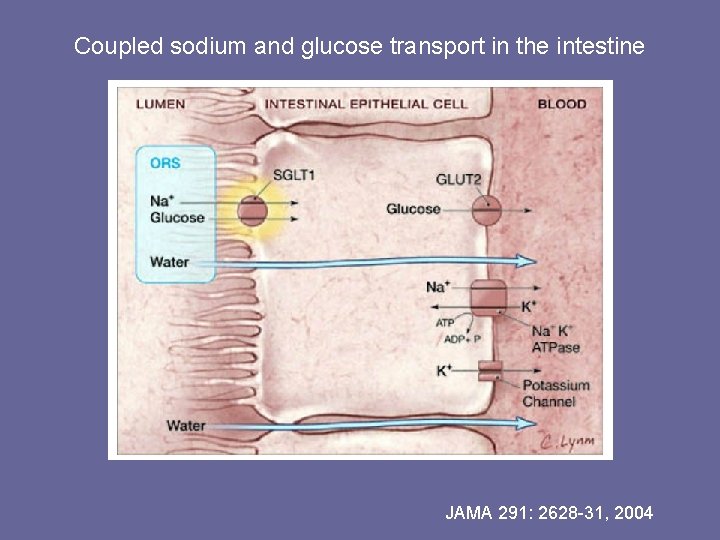 Coupled sodium and glucose transport in the intestine JAMA 291: 2628 -31, 2004 