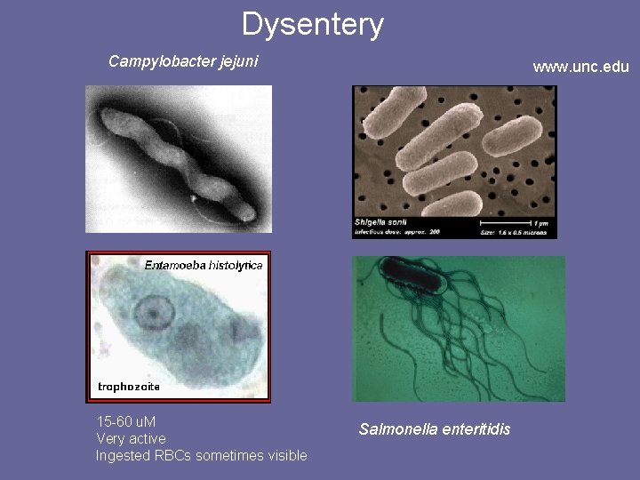 Dysentery Campylobacter jejuni 15 -60 u. M Very active Ingested RBCs sometimes visible www.