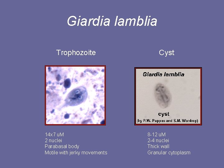 Giardia lamblia Trophozoite 14 x 7 u. M 2 nuclei Parabasal body Motile with