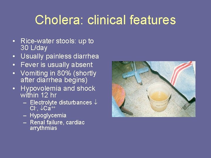 Cholera: clinical features • Rice-water stools: up to 30 L/day • Usually painless diarrhea