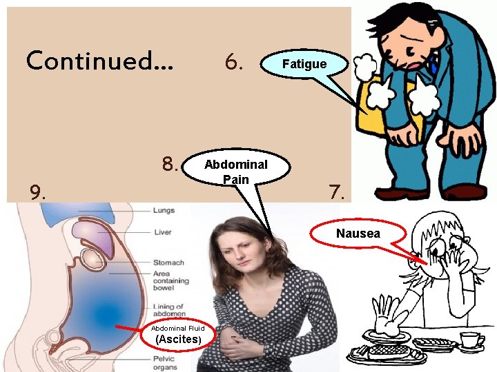 Continued… 8. 9. 6. Abdominal Pain Fatigue 7. Nausea Abdominal Fluid (Ascites) 