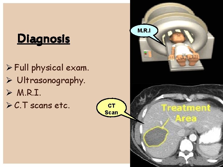M. R. I Diagnosis Full physical exam. Ultrasonography. M. R. I. C. T scans