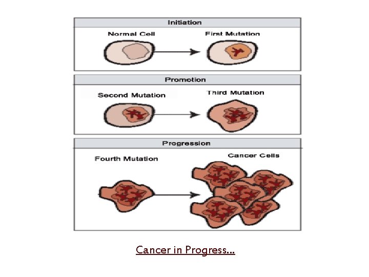Cancer in Progress… 