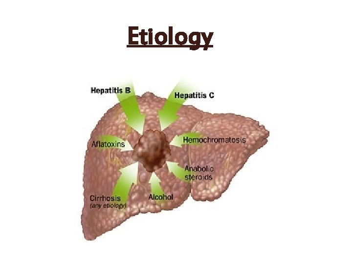 Etiology 