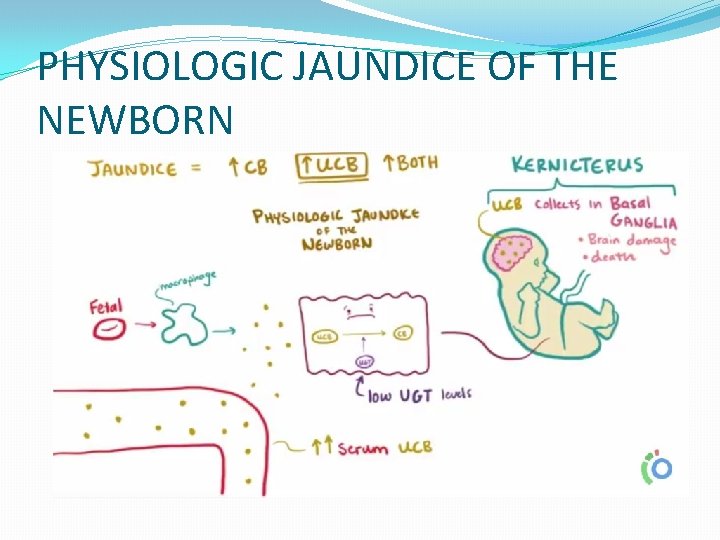 PHYSIOLOGIC JAUNDICE OF THE NEWBORN PHYSIOLOGIC JAUNDICE OF THE NEWBORN