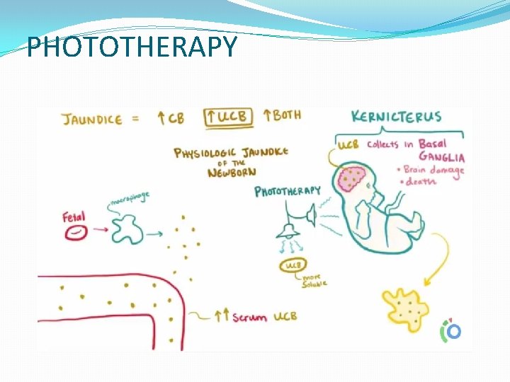 PHOTOTHERAPY PHOTOTHERAPY