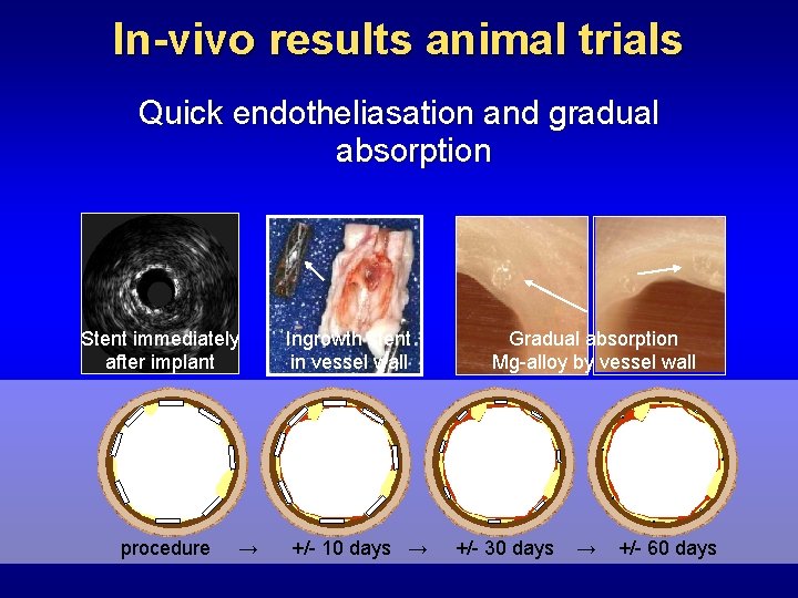 In-vivo results animal trials Quick endotheliasation and gradual absorption Stent immediately after implant procedure