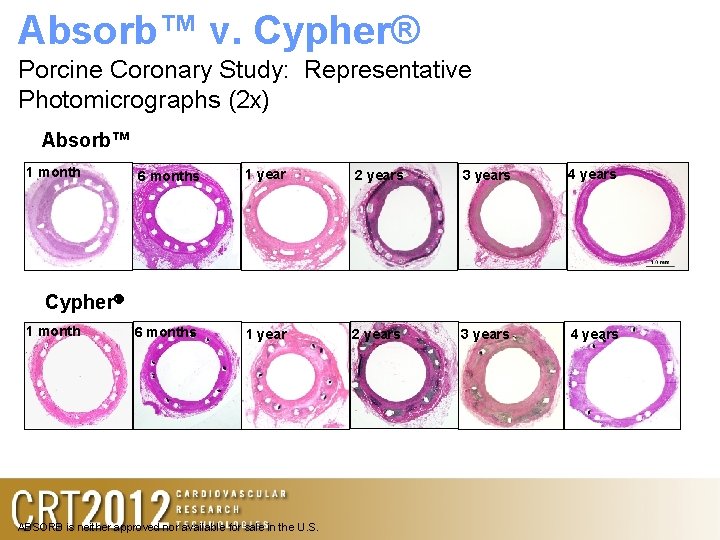 Absorb™ v. Cypher® Porcine Coronary Study: Representative Photomicrographs (2 x) Absorb™ 1 month 6