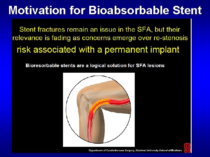 Motivation for Bioabsorbable Stent 