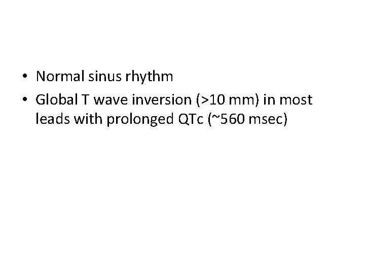  • Normal sinus rhythm • Global T wave inversion (>10 mm) in most