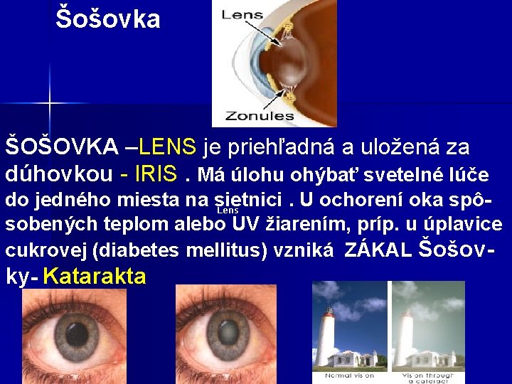 Šošovka ŠOŠOVKA –LENS je priehľadná a uložená za ŠOŠOVKA dúhovkou - IRIS. Má úlohu