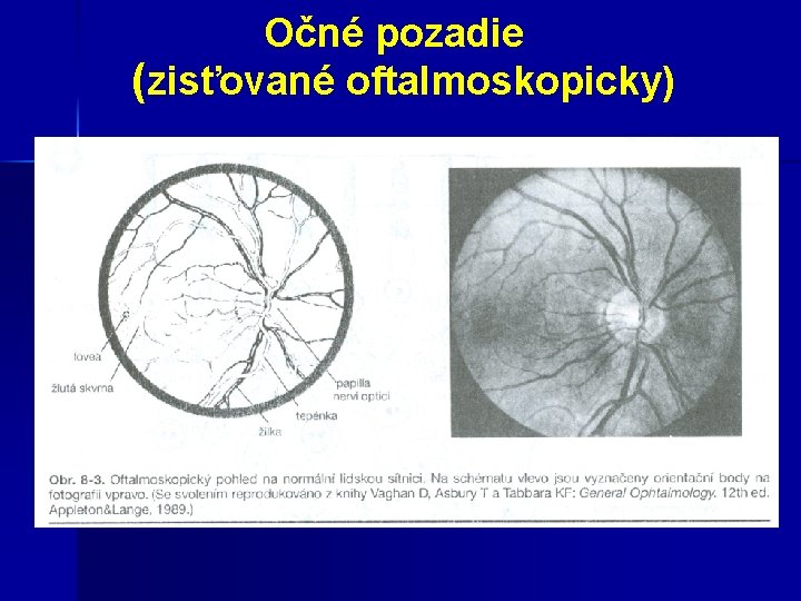  Očné pozadie (zisťované oftalmoskopicky) 