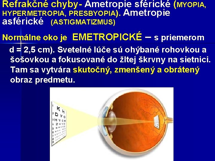 Refrakčné chyby- Ametropie sférické (MYOPIA, HYPERMETROPIA, PRESBYOPIA). Ametropie asférické (ASTIGMATIZMUS) Normálne oko je EMETROPICKÉ