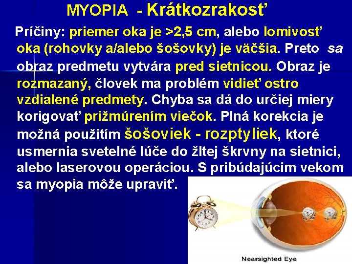  MYOPIA - Krátkozrakosť Príčiny: priemer oka je >2, 5 cm, alebo lomivosť oka