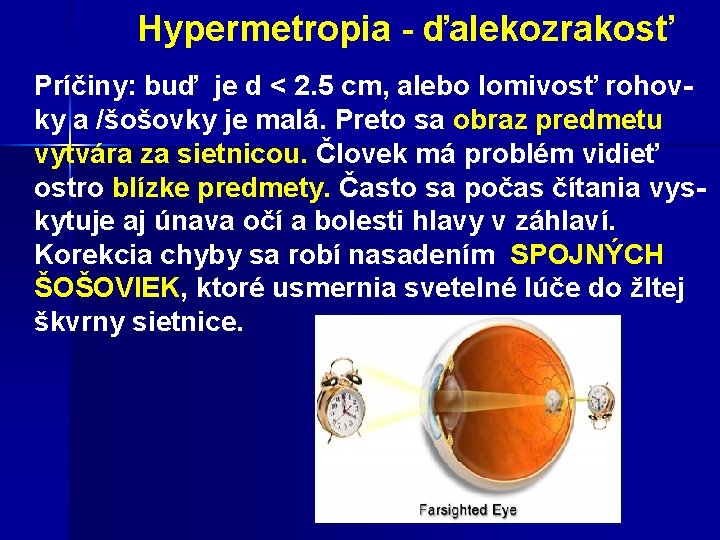  Hypermetropia - ďalekozrakosť Príčiny: buď je d < 2. 5 cm, alebo lomivosť