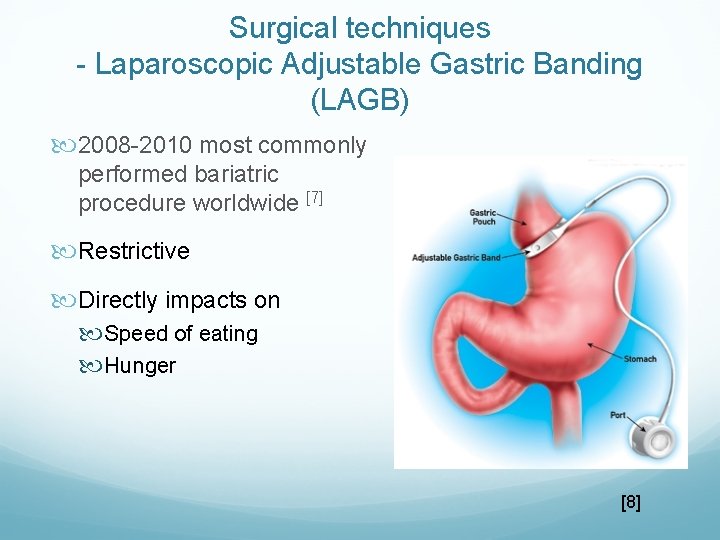 Surgical techniques - Laparoscopic Adjustable Gastric Banding (LAGB) 2008 -2010 most commonly performed bariatric