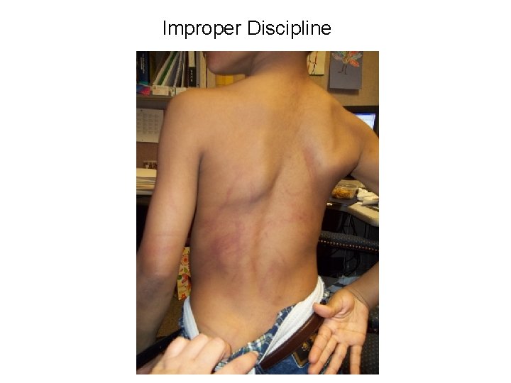 Improper Discipline 