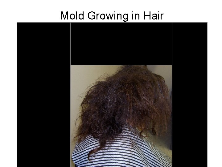 Mold Growing in Hair 