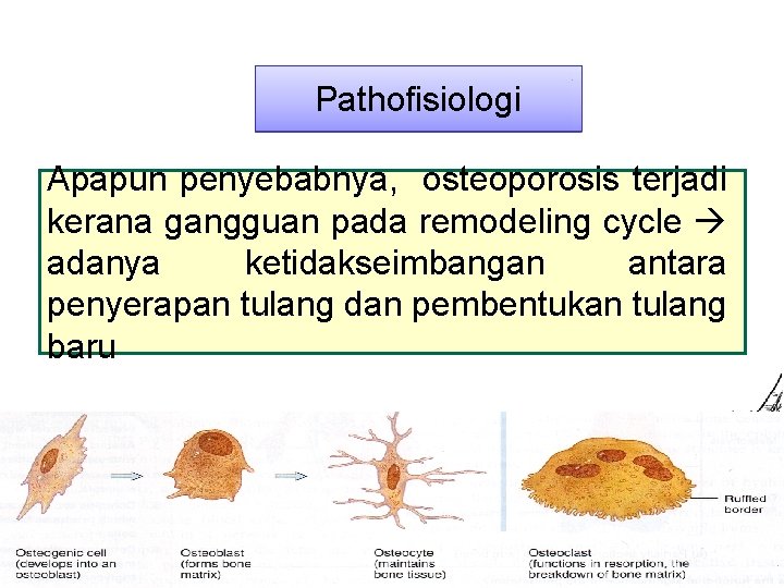 Pathofisiologi Apapun penyebabnya, osteoporosis terjadi kerana gangguan pada remodeling cycle adanya ketidakseimbangan antara penyerapan