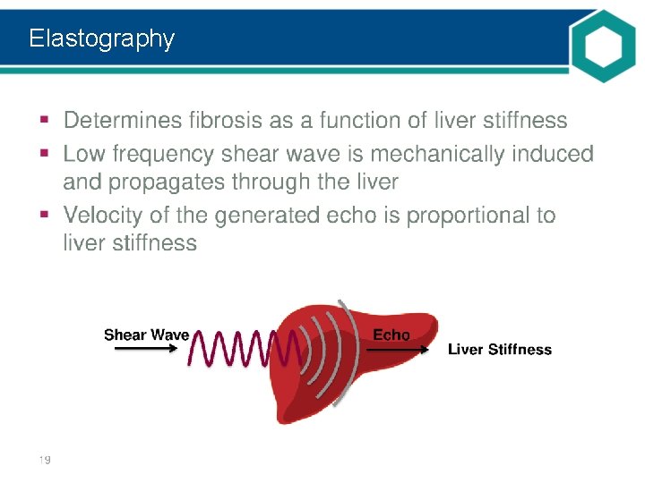 Elastography 