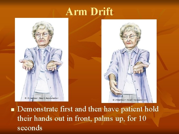 Arm Drift n Demonstrate first and then have patient hold their hands out in