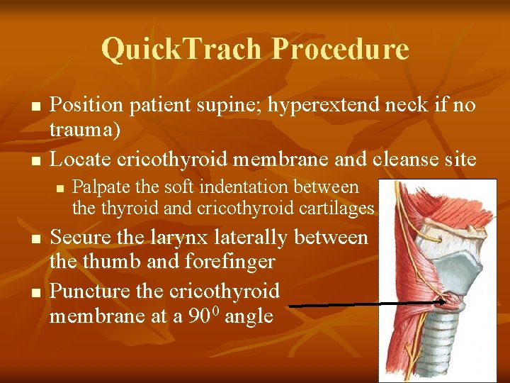 Quick. Trach Procedure n n Position patient supine; hyperextend neck if no trauma) Locate