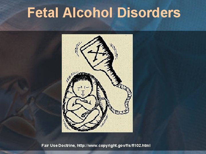 Fetal Alcohol Disorders Fair Use Doctrine, http: //www. copyright. gov/fls/fl 102. html 